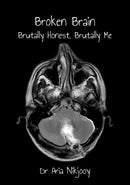 Broken Brain: Brutally Honest, Brutally Me