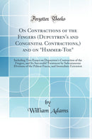 On Contractions of the Fingers (Dupuytren's and Congenital Contractions,) and on "Hammer-Toe": Including Two Essays on Dupuytren's Contraction of the Fingers, and Its Successful Treatment by Subcutaneous Divisions of the Palmar Fascia, and Immediate