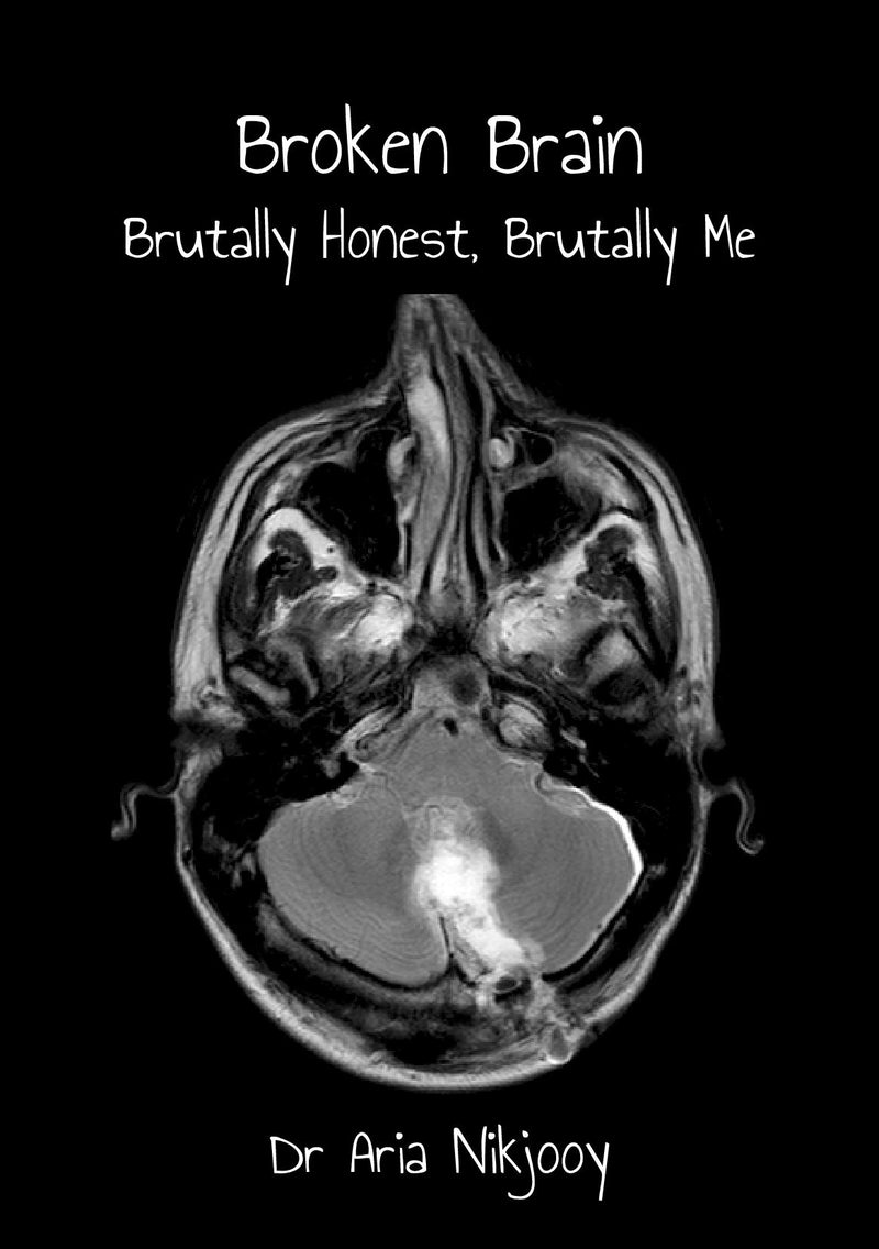 Broken Brain: Brutally Honest, Brutally Me